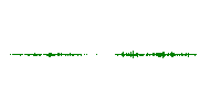 Plastic Bag (Foley) A1 Sound Effect